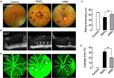 Protective Effect of Hydrogen on Sodium Iodate-Induced Age-Related Macular Degeneration in Mice